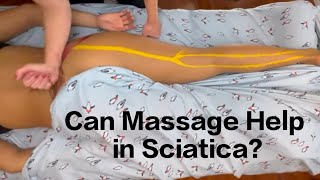 Can massage help in sciatica [upl. by Wayland]