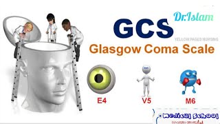 مقياس جلاسكو Glasgow Coma Scale [upl. by Llerud]