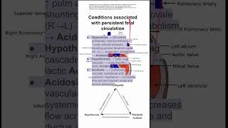 Conditions associated with persistent fetal circulation [upl. by Ayekehs]