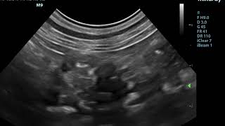 Small Animal Ultrasound  Pancreatitis in a cat [upl. by Imnubulo]