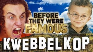 KWEBBELKOP  Before They Were Famous  Biography [upl. by Malik]