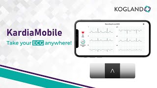 Kardia Mobile  Easy amp Reliable ECG Monitoring Anytime Anywhere [upl. by Nytsud966]