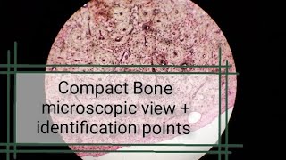 Compact Bone microscopic view  histology slides  bone Histology and identification points CT [upl. by Hudnut719]