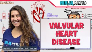 Valvular Heart Disease amp Mechanical Heart Valves [upl. by Hnid977]