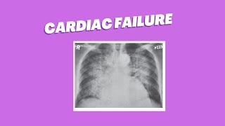 Congestive Cardiac Failure [upl. by Alocin]