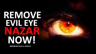 REMOVE EVIL EYE NOW  Very Powerful  MUST WATCH [upl. by Eirrak]