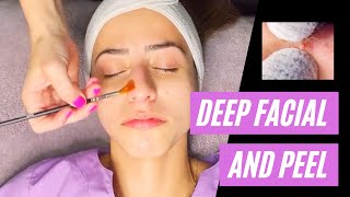 DEEP CLEANSING FACIAL WITH EXTRACTIONS amp A CHEMICAL PEEL USING PCA SKIN [upl. by Enayd]