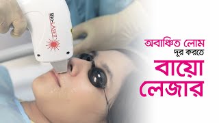 অবাঞ্ছিত লোমের দীর্ঘস্থায়ী সমাধানে বায়োজিনের BioLaser ট্রিটমেন্ট  Bioxin Cosmeceuticals [upl. by Aniryt]