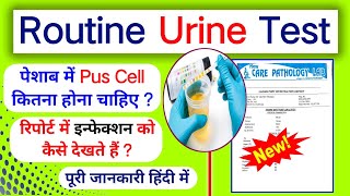 Routine Urine Test Report Kaise dekhe।।Pus Cell in urine।।Pus Cell kya hota hai।। [upl. by Nohsal202]