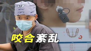 牙齿补错导致咬合紊乱？如何矫正复杂咬合问题！ [upl. by Allsopp]