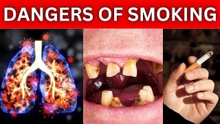 15 Harmful Effects Of Smoking And Vaping [upl. by Aitekram]