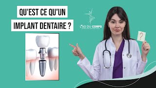 QUEST CE QUUN IMPLANT DENTAIRE   Las du corps [upl. by Florian]