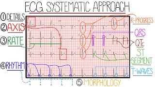 ECG Interpretation Made Easy Learn How to Interpret an ECG in 13 Minutes [upl. by Niabi]