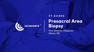 Micromate™  CTguided RoboticAssisted Presacral Area Biopsy [upl. by Vivian]