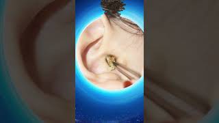 quotOddly Satisfying Ear Wax Removal Compilation – Deep Clean for Clear Hearingquot [upl. by Hamilah]