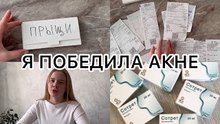 Я победила акне  системные ретиноиды  ежедневный уход  чистки и пилинги  моя история [upl. by Mora733]