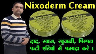 nixoderm for skin problems nixoderm ke fayde निक्सोडर्म [upl. by Dubenko]