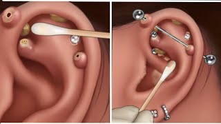 Ear Treatment  Removel Earrings Clean Dirt asmr tunnigasmr [upl. by Savage]