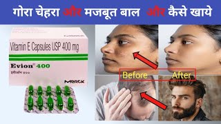 Evion 400 capsule uses in Hindi  Evion 400 capsule  Vitamin E capsule [upl. by Godewyn]