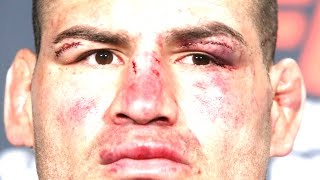 CAIN VELASQUEZ INJURED PULLED UFC 207 VS FABRICIO WERDUM NSAC SHOCKING [upl. by Imogene]