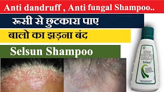 selsun shampoo for dandruff Use amp benifit best treatment of dandruff  Anti dandruff shampoo [upl. by Laurance]