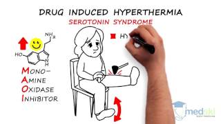 Emergency Medicine  Hyperthermia By Anjali Hulbanni MD and Mudassir Khan MD [upl. by Jeramey]