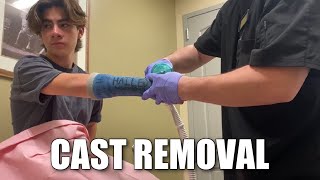 WATCH ME GET MY CAST REMOVED FOR THE FIRST TIME Broken Wrist  Full Cast Removal Procedure [upl. by Francesca41]