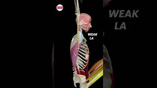 Weak latissimus dorsi strengthtraining [upl. by Keldon]