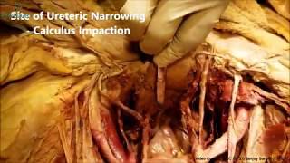 URINARY BLADDER CADAVERIC DISSECTION  Human Anatomy Cadaveric Dissection Videos [upl. by Dewees]