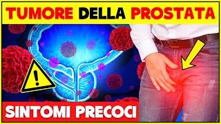 Sintomi Precoci Del Tumore Alla Prostata I Campanelli Di Allarme a Cui Devi Prestare Attenzione [upl. by Lorenzo]