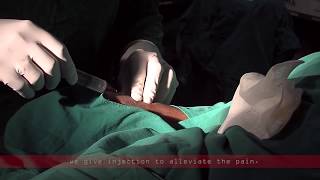 Coronary angiogram  a live demonstration [upl. by Crespo]