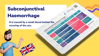 Subconjunctival Hemorrhage A Quick Overview  Ophthalmology [upl. by Lramaj988]