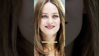 7 celebrities with the worst teeth conditionsmovie hollywood entertainment actor usacelebrity [upl. by Publias]