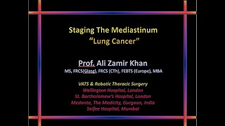 Staging the mediastinum in Lung Cancer [upl. by Snashall934]