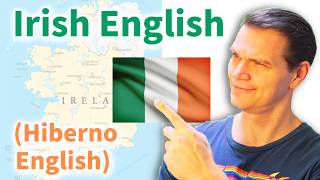 IRISH English and What Makes it Different [upl. by Eldin22]