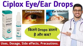 Ciplox EyeEar drops uses in hindi  Ciplox Eye drops  Ciplox Ear drops  Ciprofloxacin eye drops [upl. by Cicily]