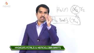 hemoglobin barts hydrops fetalis syndrome  Usmle quick review [upl. by Eenitsed]