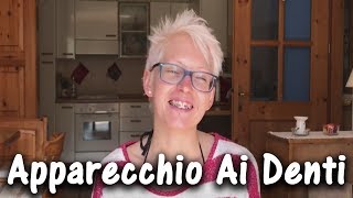 APPARECCHIO ORTODONTICO  Perché Solo Adesso e Prime Impressioni 1 [upl. by Concettina]