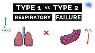 Type 1 vs Type 2 Respiratory Failure  ABG Interpretation  UKMLA  CPSA [upl. by Laina]