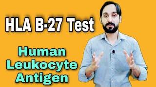 HLA B27 Test  Human Leukocyte Antigen [upl. by Hamal706]