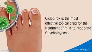 Ciclopirox is the most effective topical drug for the treatment of mildtomoderate Onychomycosis [upl. by Eedak718]