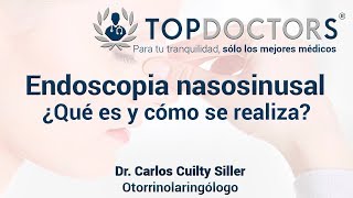 Endoscopia Nasosinusal Qué es y cómo se realiza [upl. by Rednasyl605]