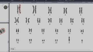 CytoCloud  Editing the karyogram [upl. by Efthim56]