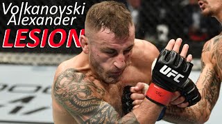 Alex Volkanovski 1st LOSS in MMA to Corey Nelson [upl. by Yerffe801]