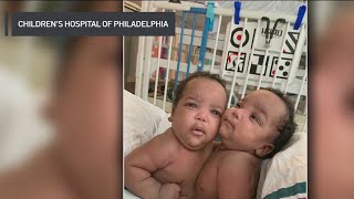 Conjoined twins return home after successful separation surgery at CHOP [upl. by Nylsor]