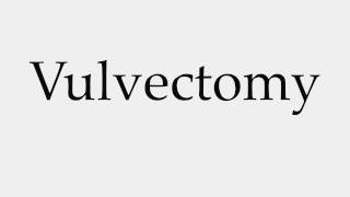 How to Pronounce Vulvectomy [upl. by Grieve683]