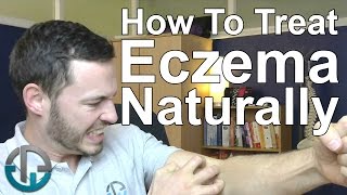 How To Treat Eczema Naturally [upl. by Einahpet]