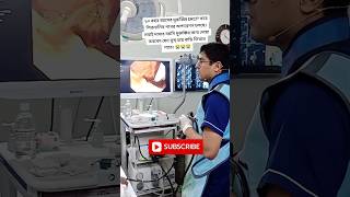 E R C P 🩺 Gallstone Operation is in Progress 🇧🇩 👈 Operation Theatre  90 Years old Man  shorts [upl. by Virgin]