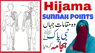 Hijama Sunnah Points  Wet Cupping  Hijama Benefits [upl. by Bridgid]