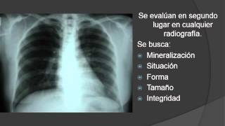 Fundamentos para Interpretación en Radiología General Simple [upl. by Ainit]